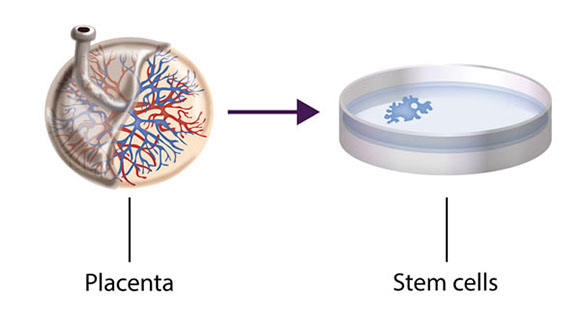 an illustration showing how a placenta provides stem cells for future Peyronie's Disease treatments