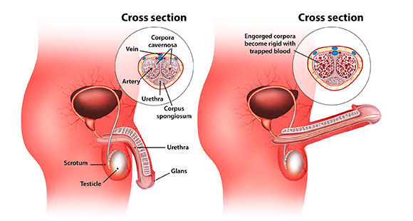 a diagram contrasting a flaccid penis versus an erect penis