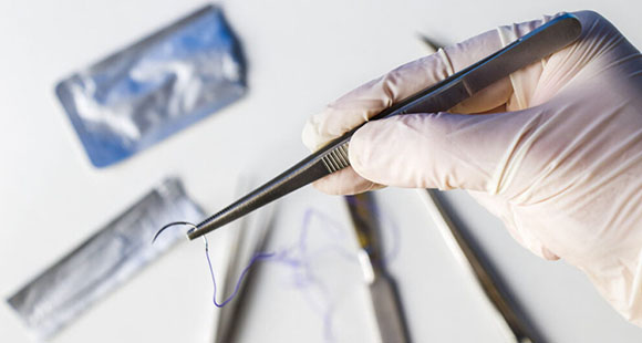 a medical professional holding a pair of forceps holding a piece of string used for stitching