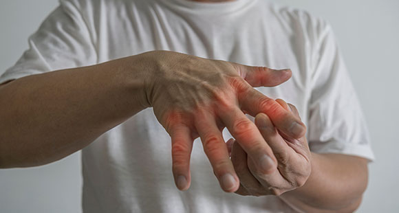 a man holding his painful fingers from arthritis 