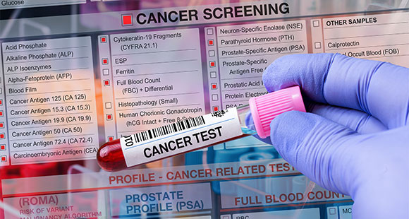 Close-up of a cancer cell highlighted in orange, surrounded by various types of cells, with a crosshair overlay targeting the cancer cell. Cellular biology and cancer research concept.