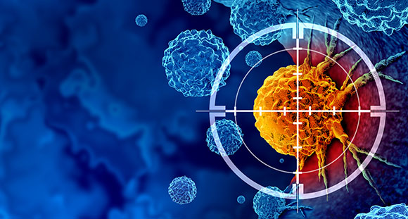 Illustration of a cancer cell highlighted in orange with surrounding structures, representing biological processes related to disease, possibly for educational purposes.