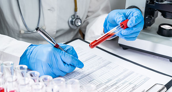 a doctor holding a vial of blood and taking notes