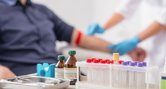 vials to hold blood on a table with a doctor taking blood from a male patient in the background