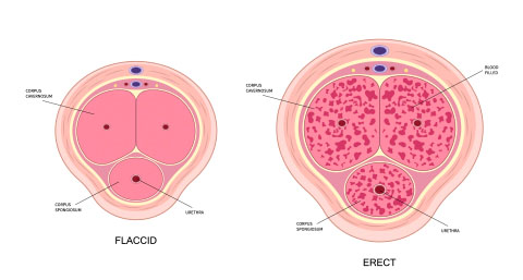 a diagram contrasting a flaccid penis versus an erect penis